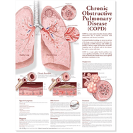 Chronic Obstructive Pulmonary Disease Anatomical Chart — Medshop Australia